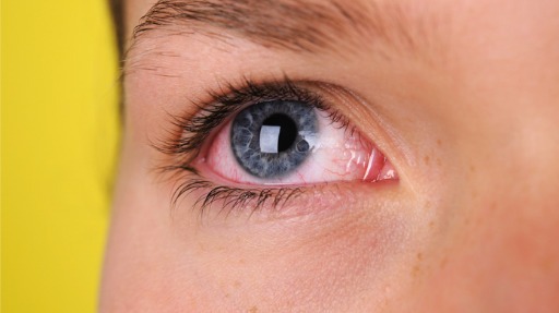 TEMPO DI ALLERGIE